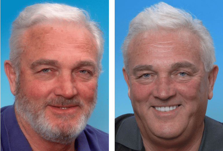 Cost of cosmetic dentistry in tenessee Dental News Network