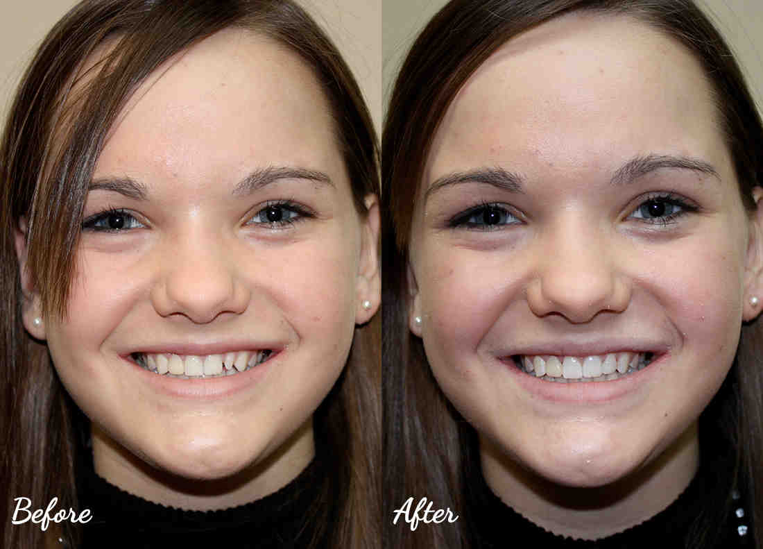 Cost of cosmetic dentistry in tenessee Dental News Network