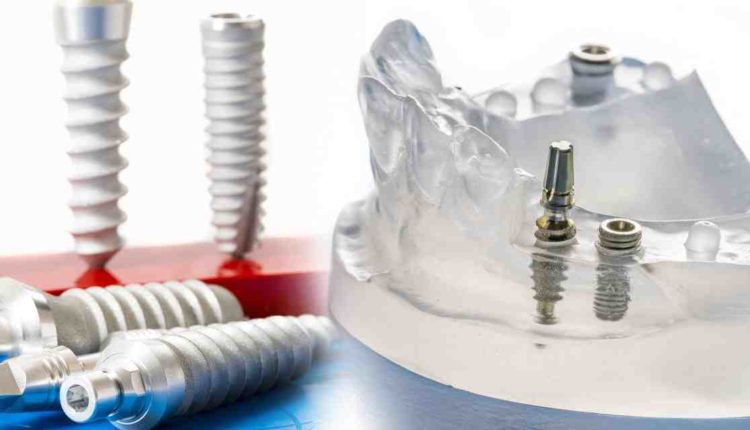How much does a clearchoice dental implant cost