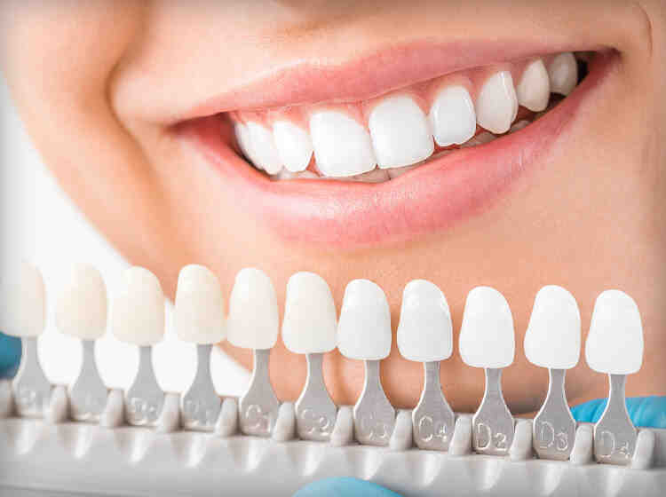 How much does a cosmetic tooth filling cost?