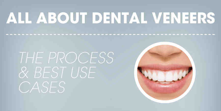 Cosmetic dentistry venneres images - Dental News Network