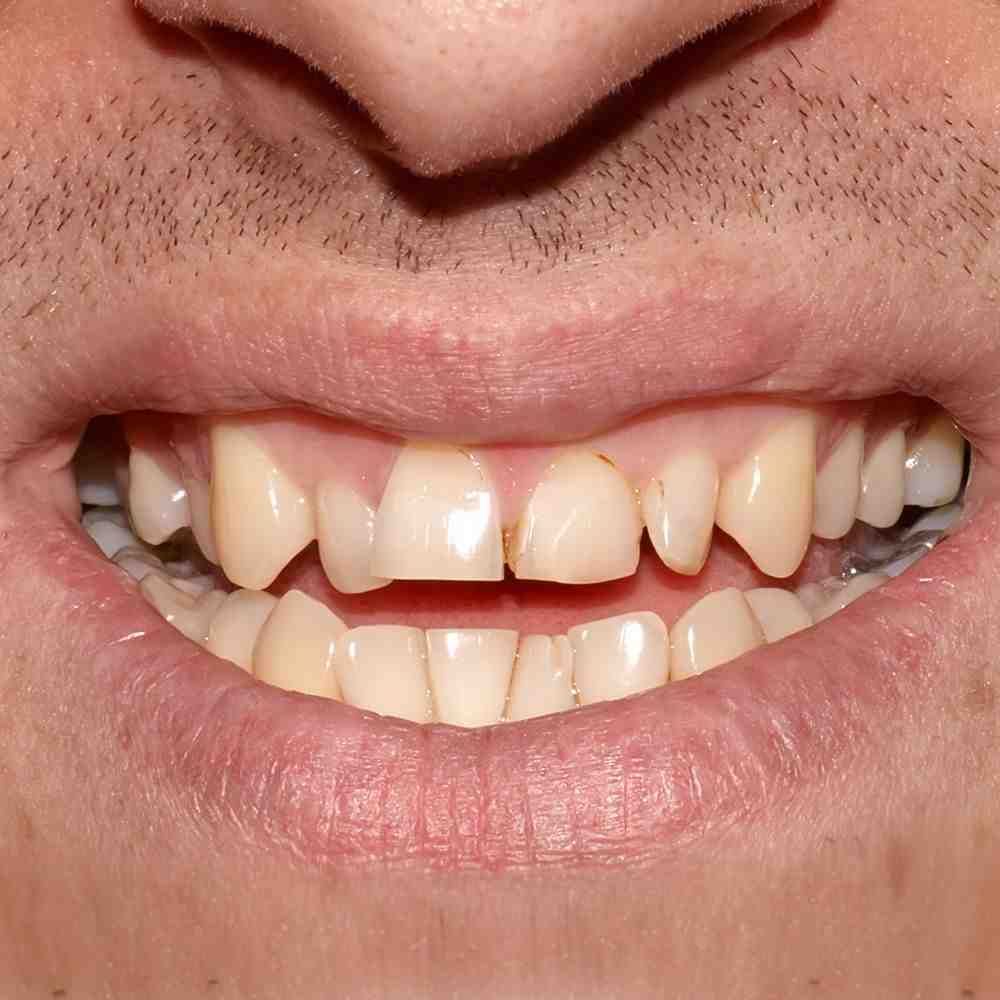 Cosmetic implant dentistry kc Dental News Network