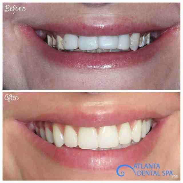 How much does cosmetic dentistry cost?