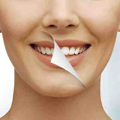 How much does it cost to get a tooth makeover?