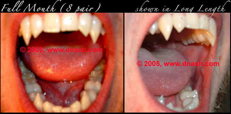 How much does it cost to get your canine teeth sharpened?