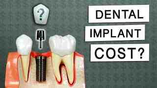 How much is too much for dental implants?