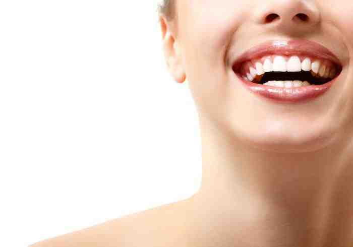 How much should dental veneers cost?