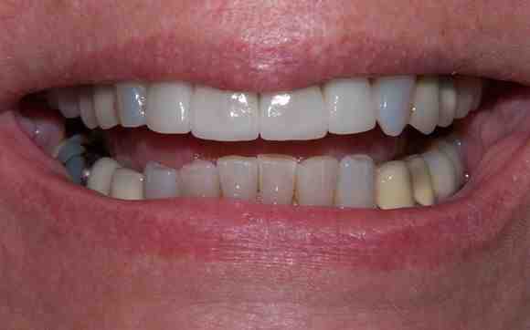 Is Delta Dental HMO or PPO?