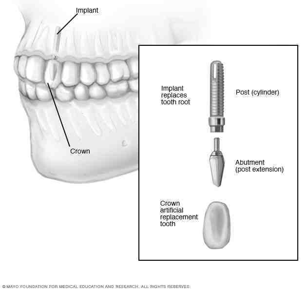 Is Mayo a nonprofit?