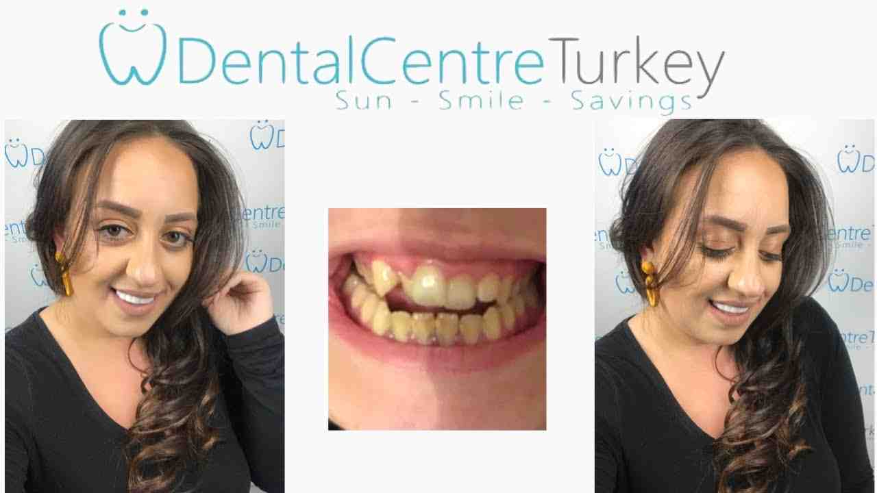 Is becoming a dentist HARD?