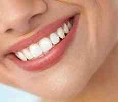 Is smile design the same as veneers?