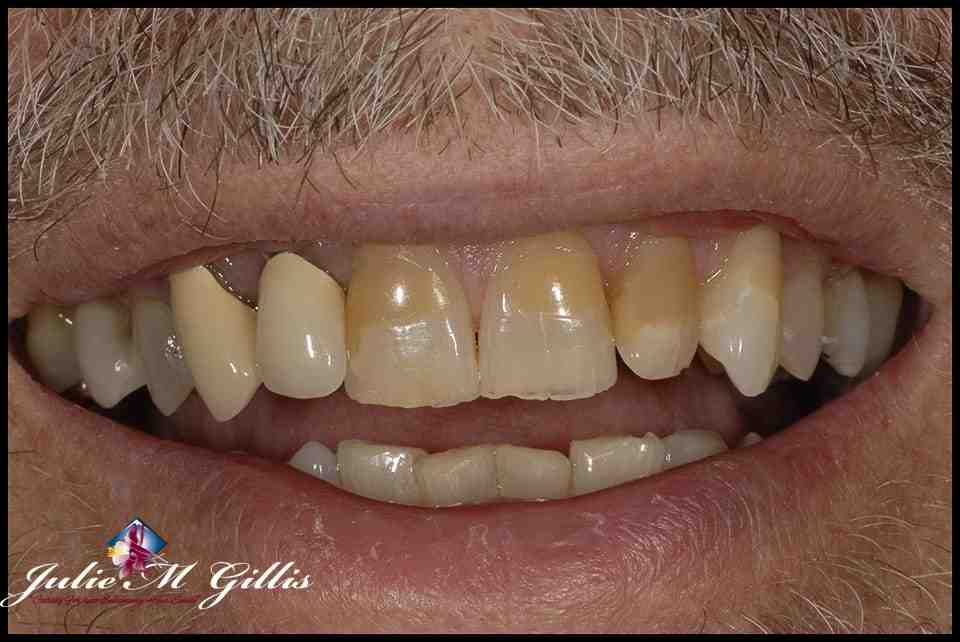 What are the most popular cosmetic dental procedures?