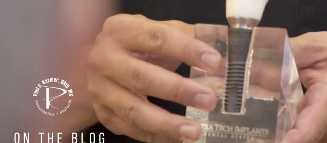 What can you not do after dental implants?