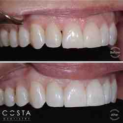 What do I do if I can't afford a dentist?