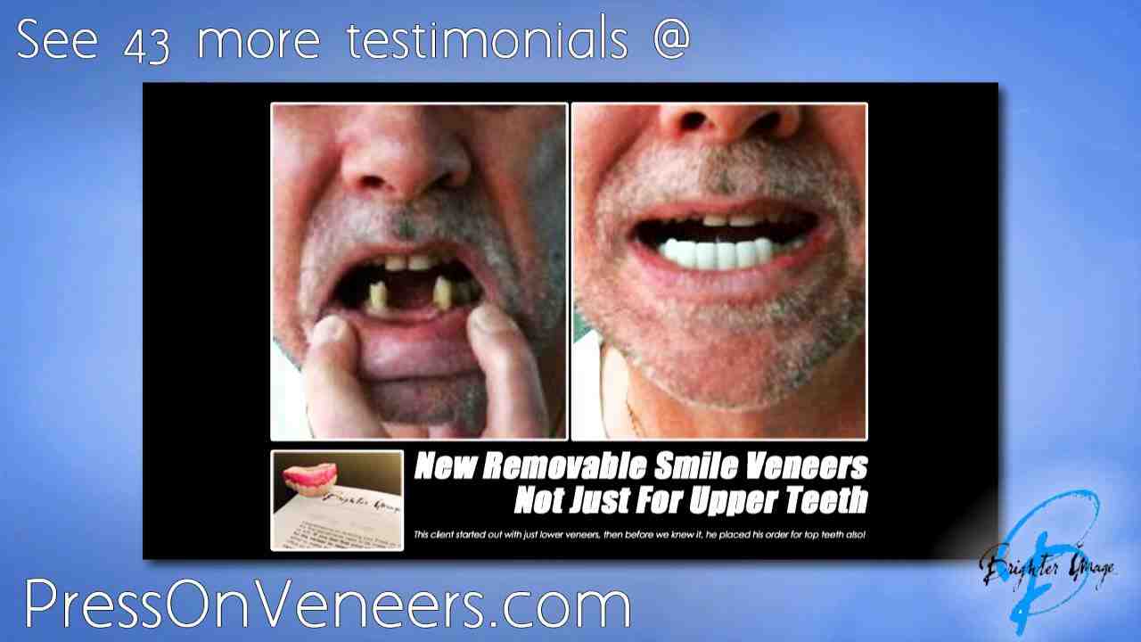 What is the average cost of dental implants in Illinois?