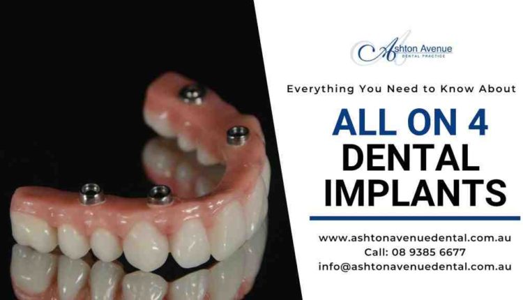 What is the cost of all on four dental implants