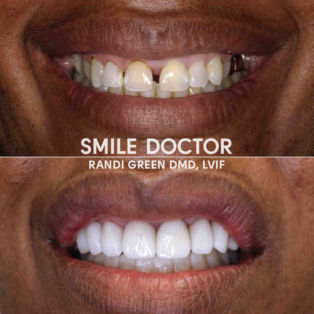 What is the movie the dentist about?