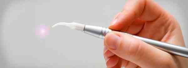 What is the movie the dentist about?