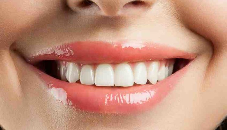 What is the price of dental implants