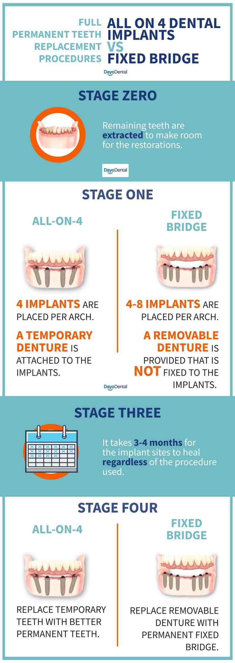 What to do while waiting for dental implants?