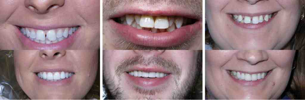 What type of dentist is a cosmetic dentist?