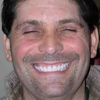 Who did the Kardashians veneers?