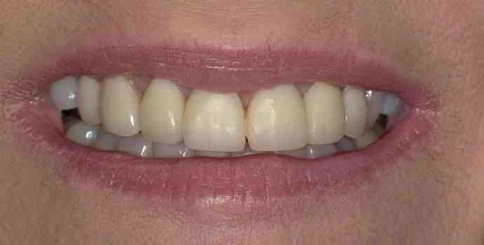 Why did the dentist go to jail?