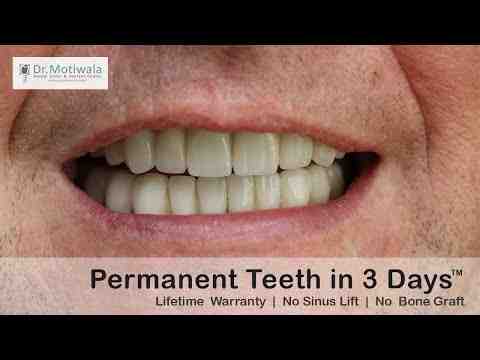 Are 6 implants better than 4?