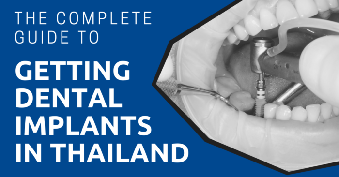 Are dental implants FDA approved?