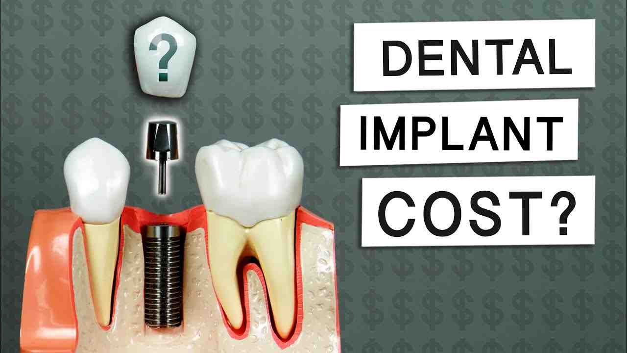 Are dental implants considered a medical procedure?