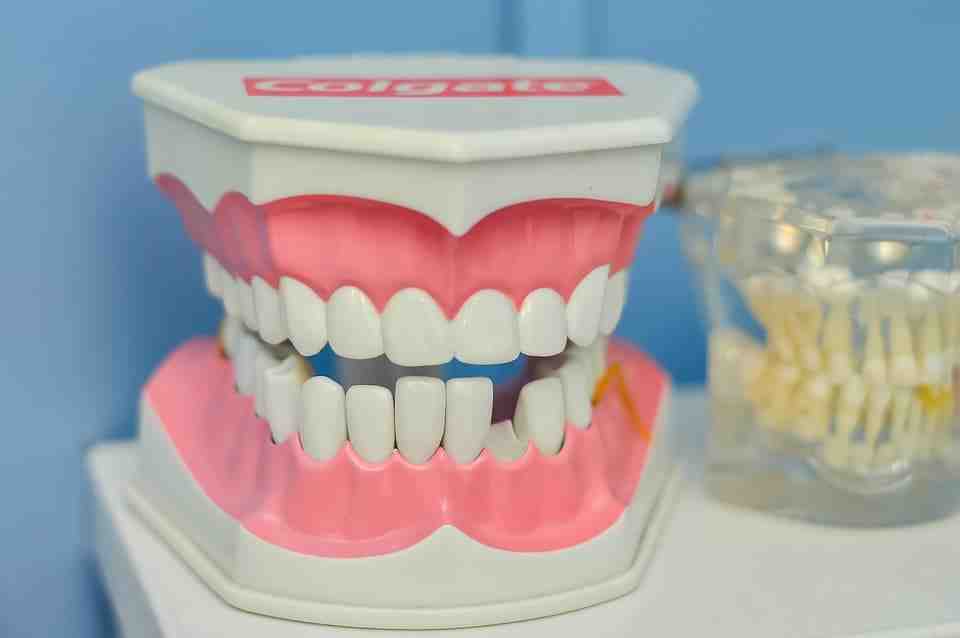 Are dental implants worth it?