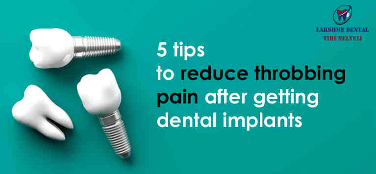 Are tooth implants worth it?