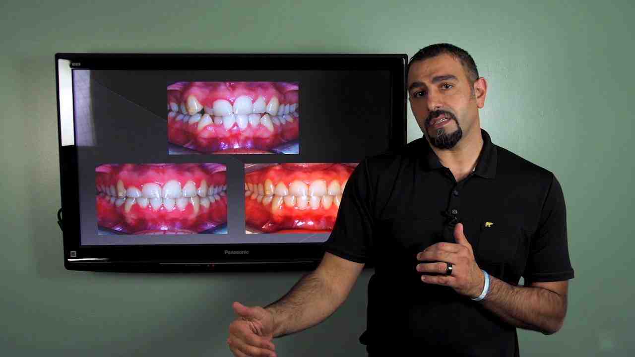 Are veneers part of orthodontics?