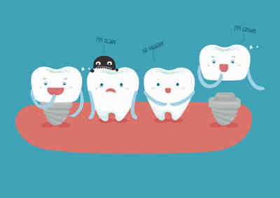 Can I drink orange juice after dental implant?