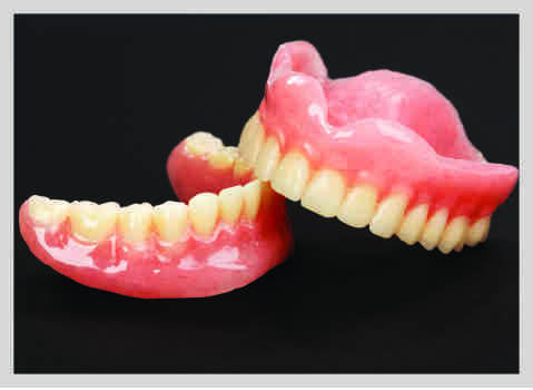 Can I get a dental implant years after extraction?