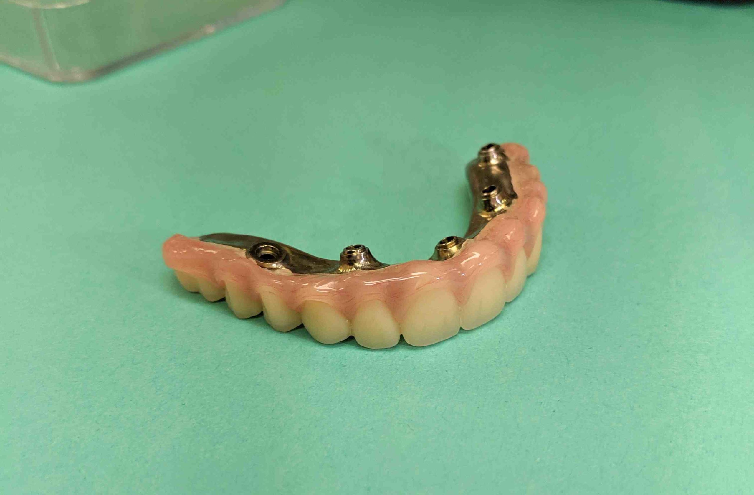 Can Medicare be used for dental implants?