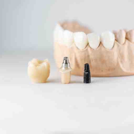 Can a punctured sinus heal on its own?