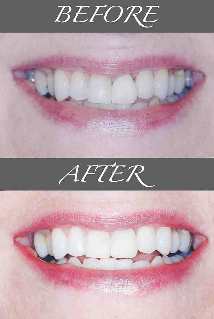 Can all dentists do cosmetic work?