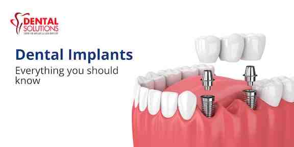 Can dental implants cause death?