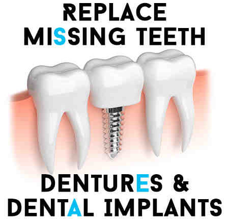 Can dental implants replace dentures