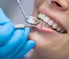 Can dentist fix yellow teeth?