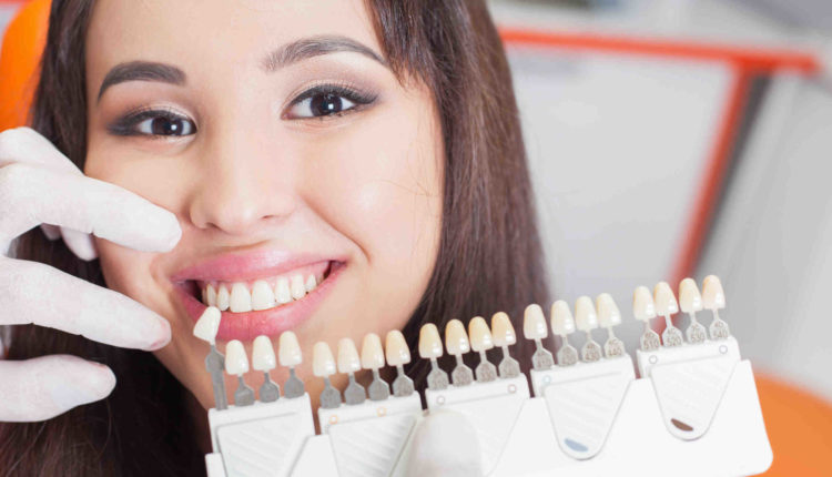 Can i get a dental implant instead of crown