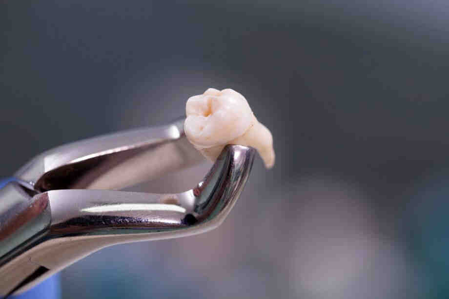 Can plastic surgery be a business write off?
