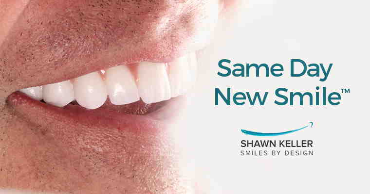 Can you bridge 3 missing teeth?