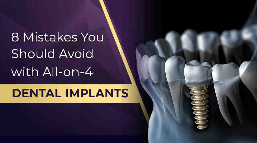 Can you get a full set of dental implants on the NHS?