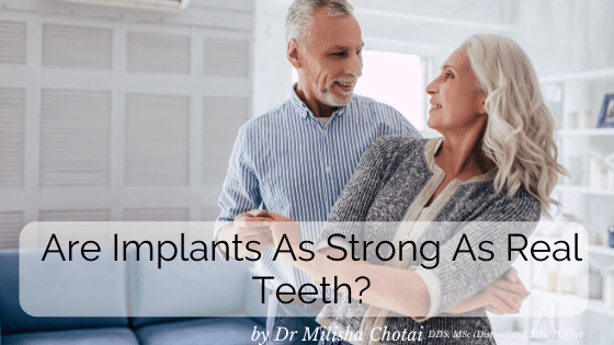 Can you put implants in front teeth?