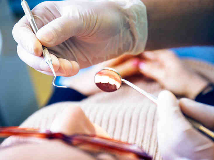 Can you reject dental implants?