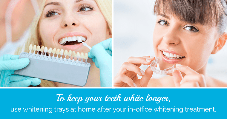 Can you use whitening toothpaste on implants?
