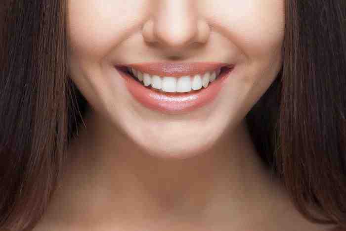 Do celebrities get their teeth done?