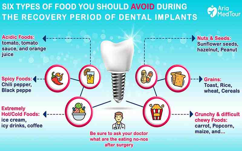 Do dental implants taste like metal?